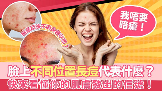 【皮膚管理】臉上不同位置長痘代表著什麽?快來看懂你的肌膚發出的信號!