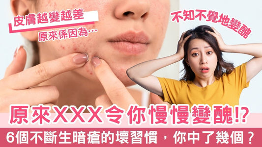 【皮膚管理】6個不斷生暗瘡的壞習慣,你中了幾個?