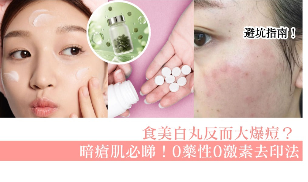 暗瘡肌內服去印終極指南：點解食美白丸會大爆痘？揭開化學成分「黑幕」與 3 大保命法則