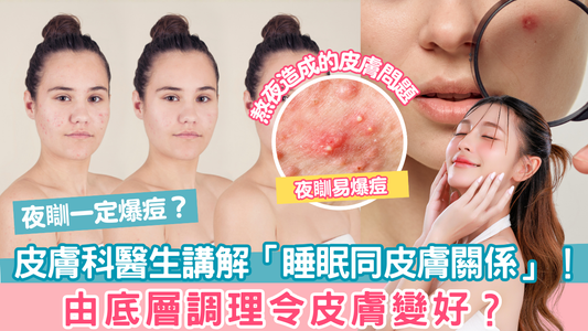 夜瞓一定爆痘？皮膚科醫生講解「睡眠同皮膚關係」！由底層調理令皮膚變好？