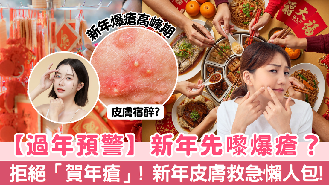 【過年預警】新年先嚟爆瘡？拒絕「賀年瘡」! 新年皮膚救急懶人包!