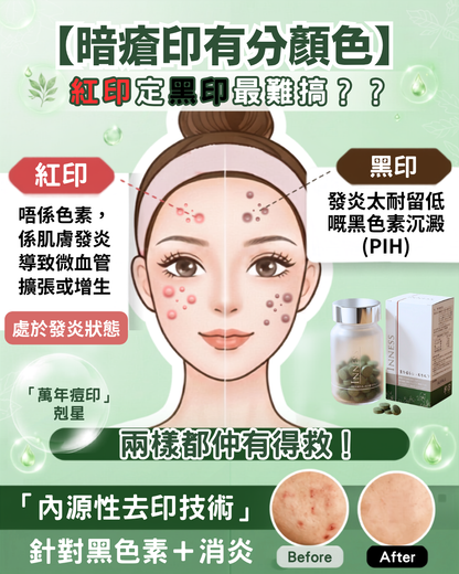 Inness 痘印種子｜痘印丸｜暗瘡印剋星｜噬黑因子｜強力除印除斑